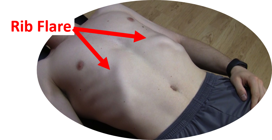 Signs of abs or just a wide rib cage? : r/xxfitness